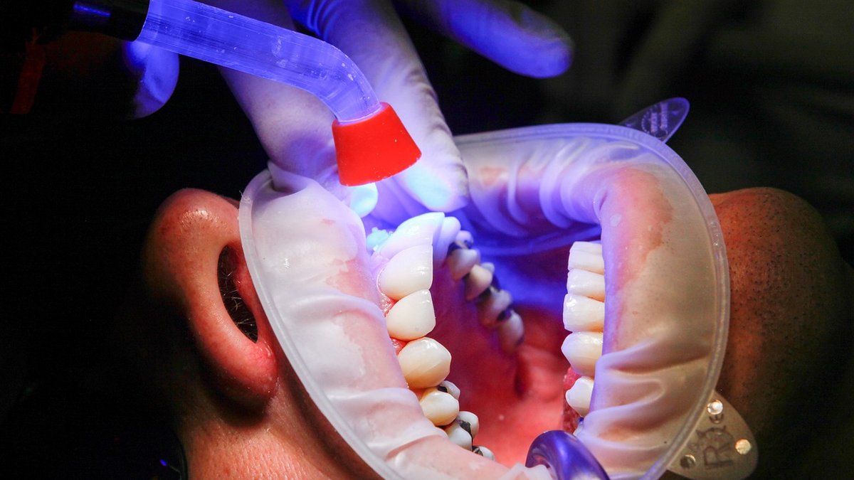 Managing Teething Discomfort in Babies and Toddlers